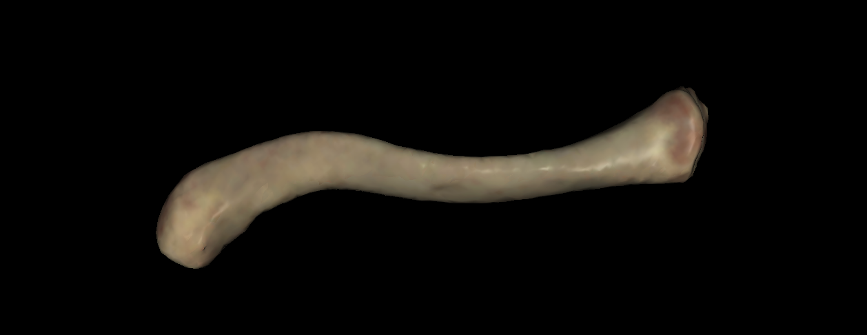 <p>left or right clavicle?</p>
