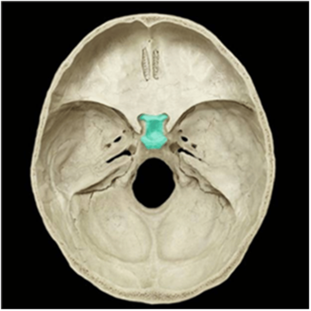 term image