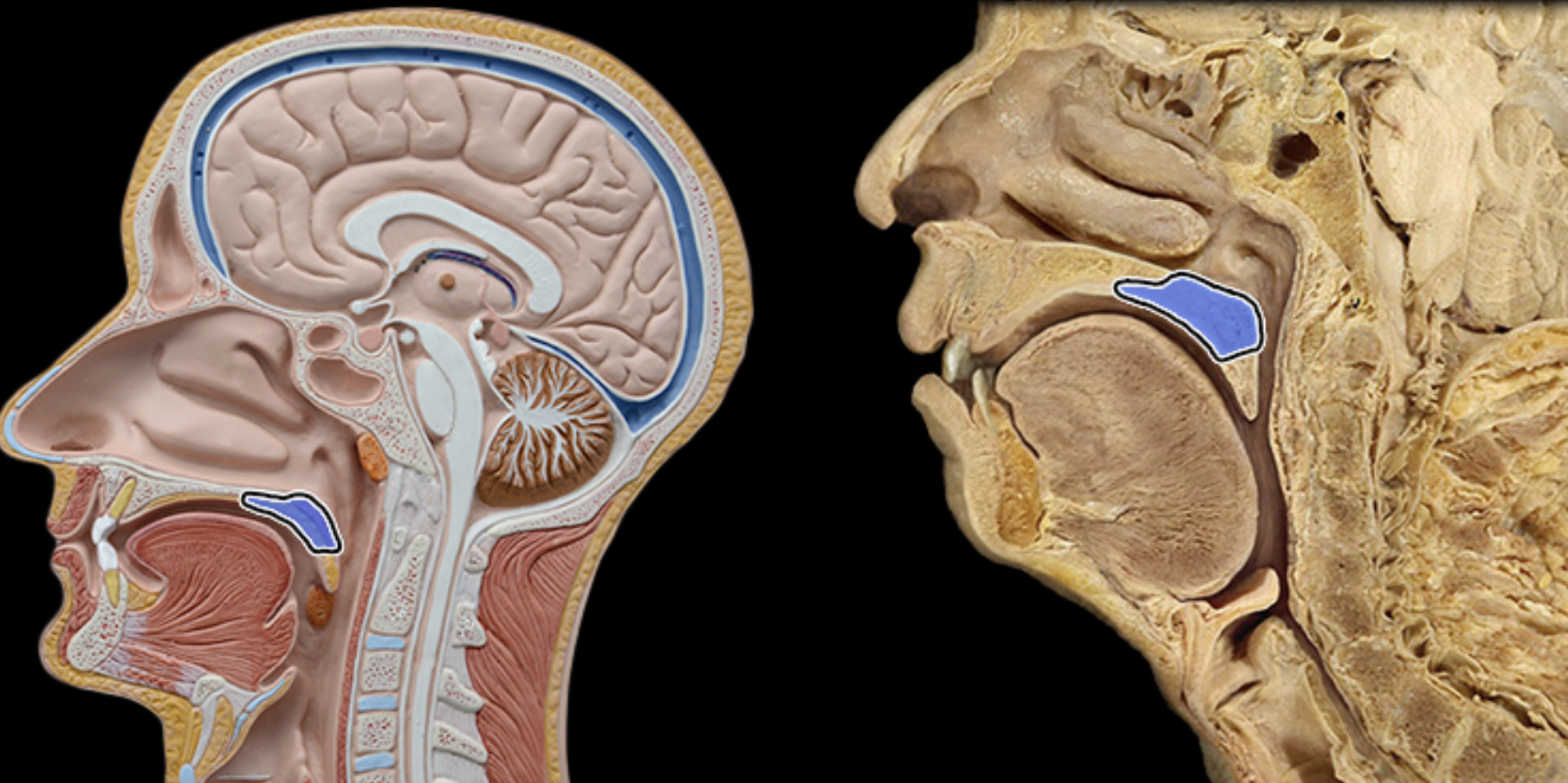 <p>Soft palate </p>