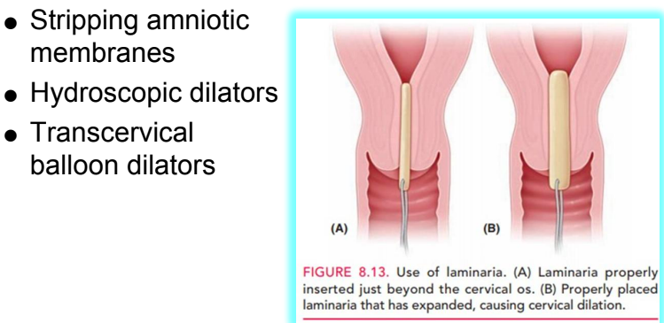 <p><strong>with cervidil</strong>, <strong>prostaglandin</strong></p><ul><li><p>stripping amniotic membranes </p></li><li><p>hydroscopic dilators: placed lower uterine segment. mechanically swells to open </p></li><li><p>trans-cervical balloon dilator: like foley. insert &amp; inflate balloon </p></li></ul><p></p>