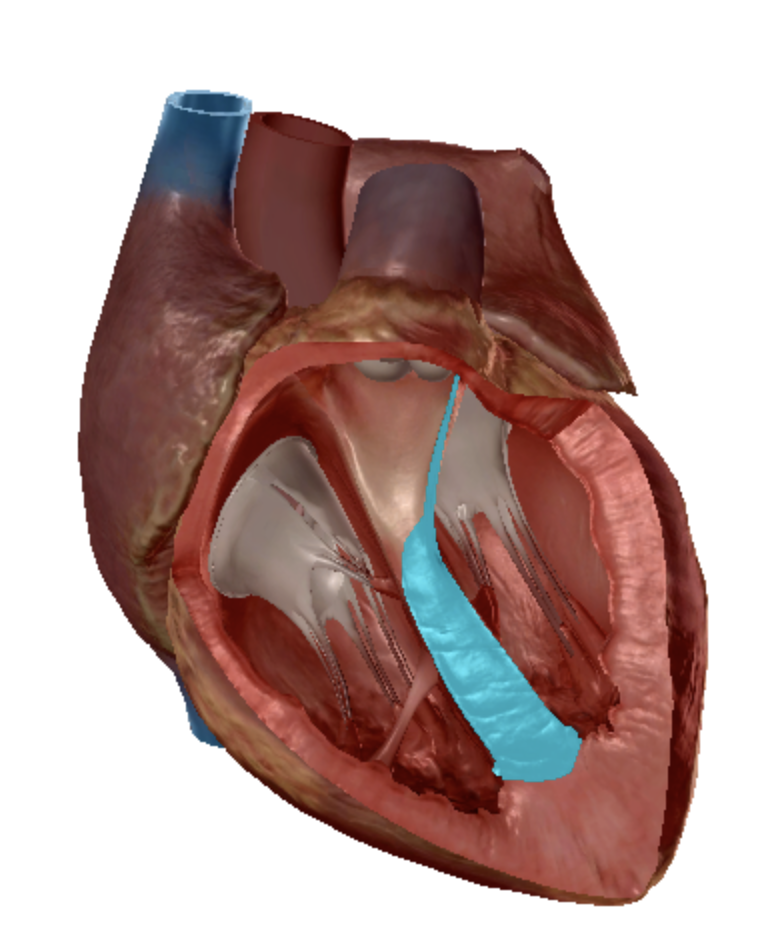 term image