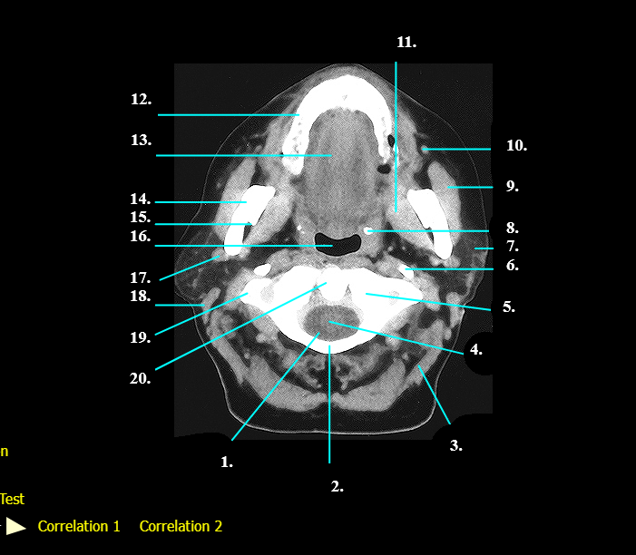 <p>Label 6 - 11</p>