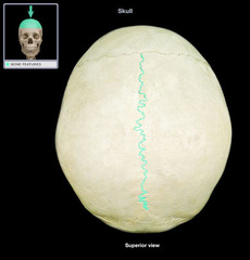 <p>What suture separates the 2 parietal bones?</p>