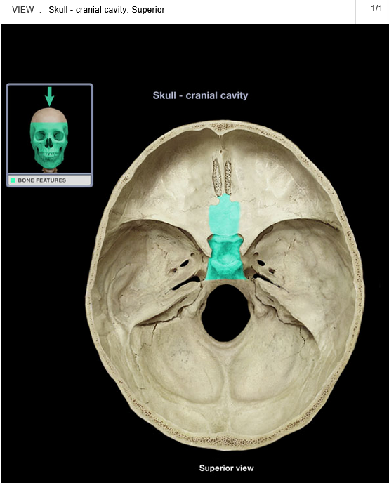 <p>Body of sphenoid bone</p>