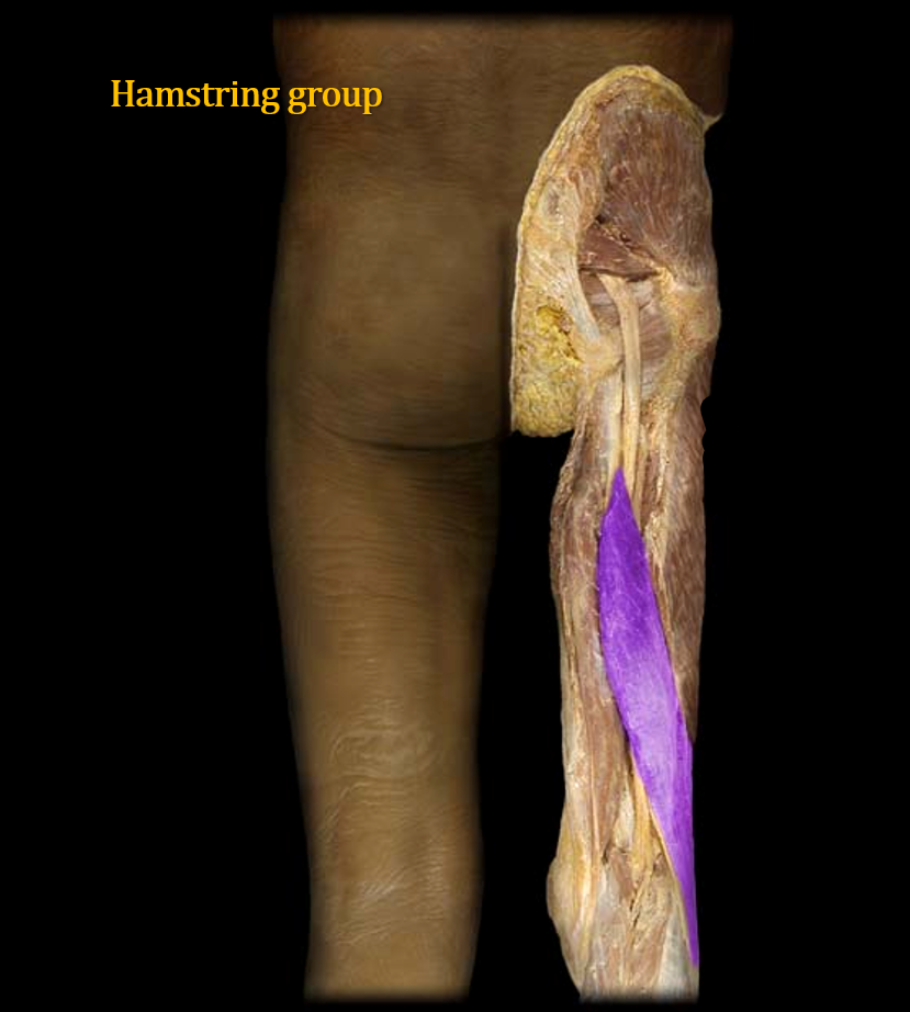 <p>What muscle is this?</p>