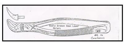 <p>Lower Molar Forceps </p>