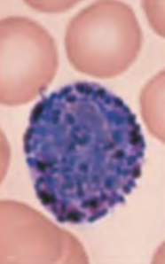 <p>What blood cell is this?</p>