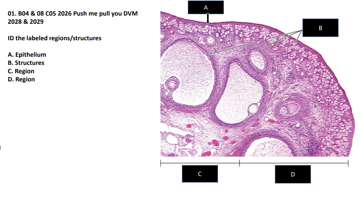 <p>ID the labeled regions/structures</p><p>A. Epithelium </p><p>B. Structures</p><p>C. Region </p><p>D. Region</p>