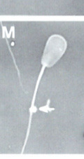 <p>What is this? Normal or abnormal sperm?</p>