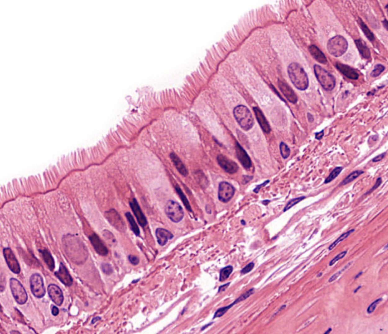 <p>tissue type</p>