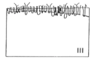 <p>Dominated by<strong> small polychaete worms</strong> </p><p>RPD layer <u>close to the sediment/water boundary layer.</u></p><p>At this stage, limited, <span style="color: red;">more or less regular events of hypoxia</span> may occur</p>