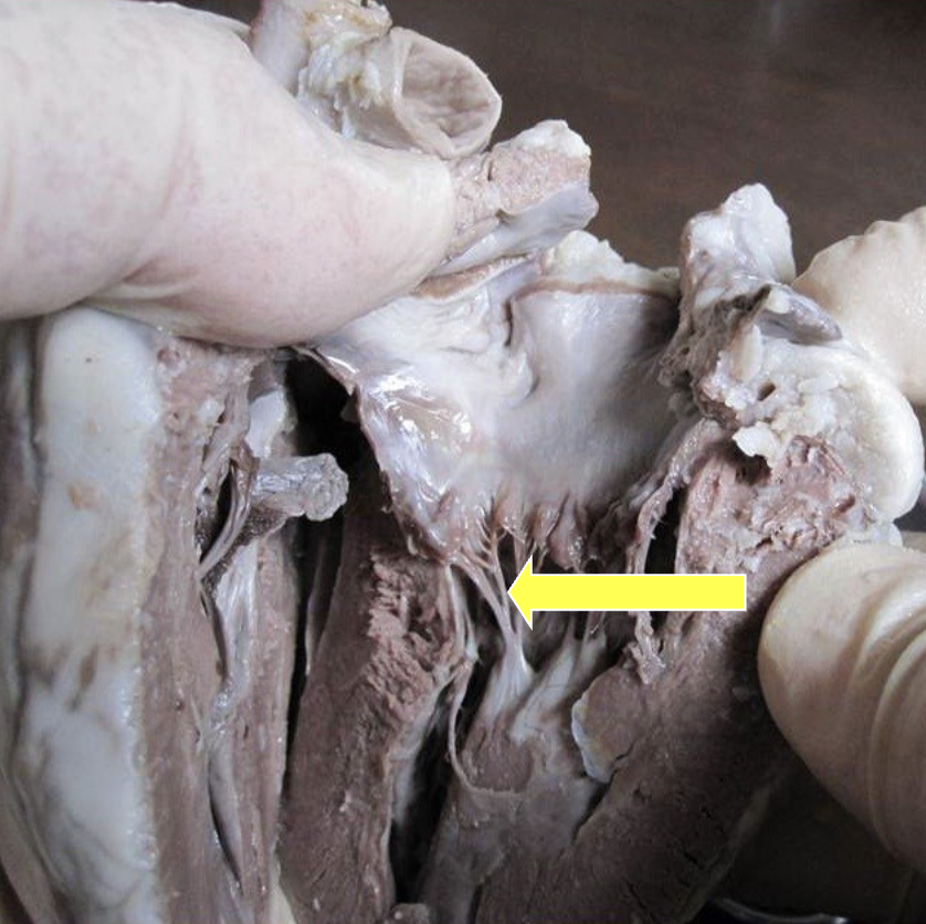 <p>what part of the sheep heart is shown?</p>