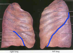 <p>Identify the structure</p>