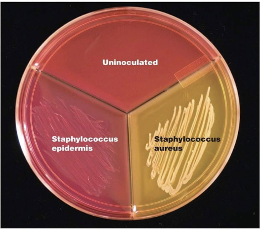 <p>It contains mannitol and a pH indicator (phenol red), where fermentation produces acid, turning the medium yellow.</p>