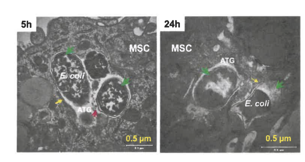 <p>&nbsp;You have joined the microscopy core at UT Southwestern medical center, and you are interested in the cytoplasmic location of the lysosome (organelle used in digesting food/foreign particles) in comparison to a small bacteria that survives phagocytosis. You hypothesize that pathogenicity of the bacteria is related to it ability to avoid fusing with the lysosome and being digested even when they are in the same cytoplasmic compartments (less than 10 nm apart). A collaborator sent them an image of E. coli being digested by the lysosome as a comparison.</p>