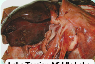 <p>PULMONARY INFARCTS</p>