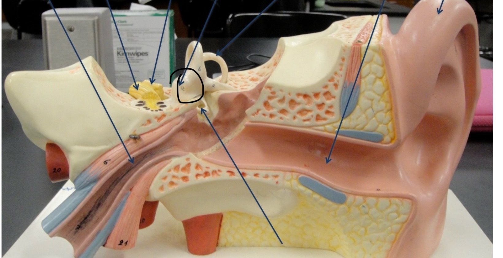 <p>Identify the circled area?</p>