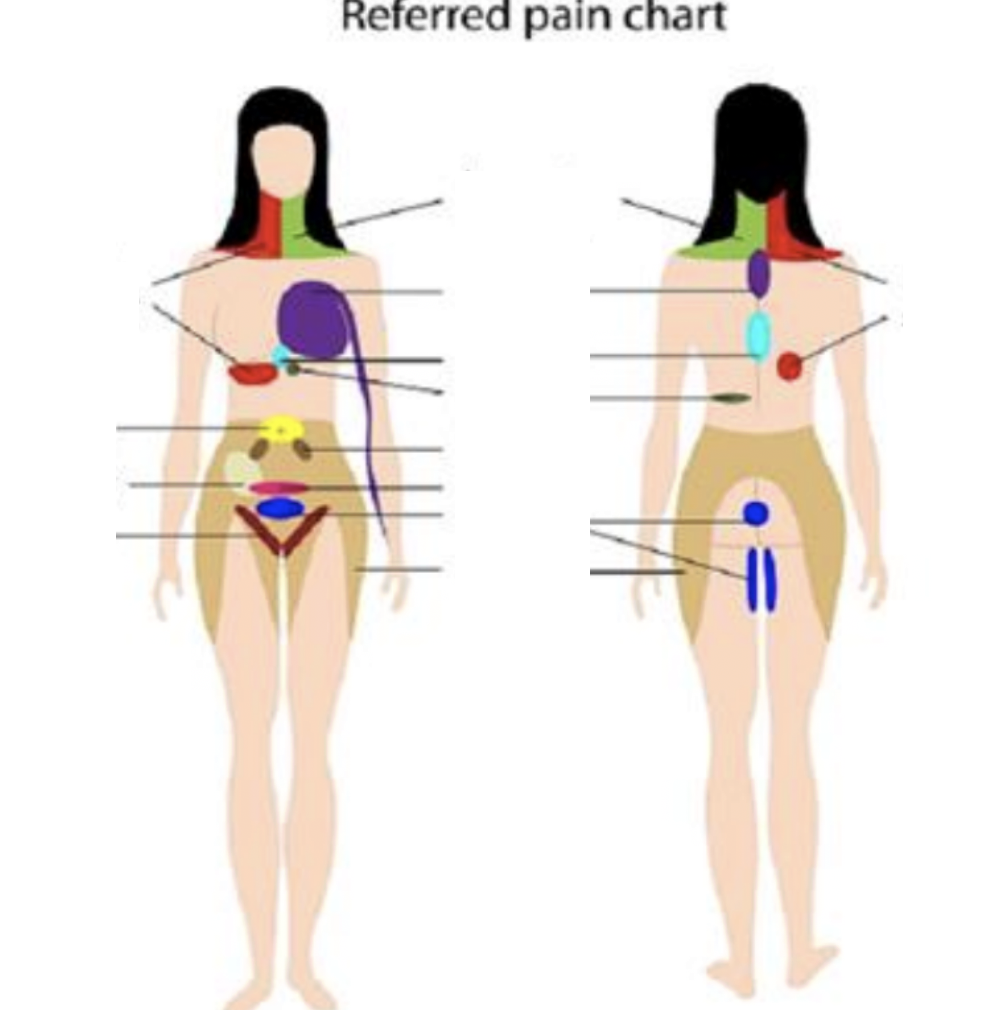 <p>Referred Pain</p>