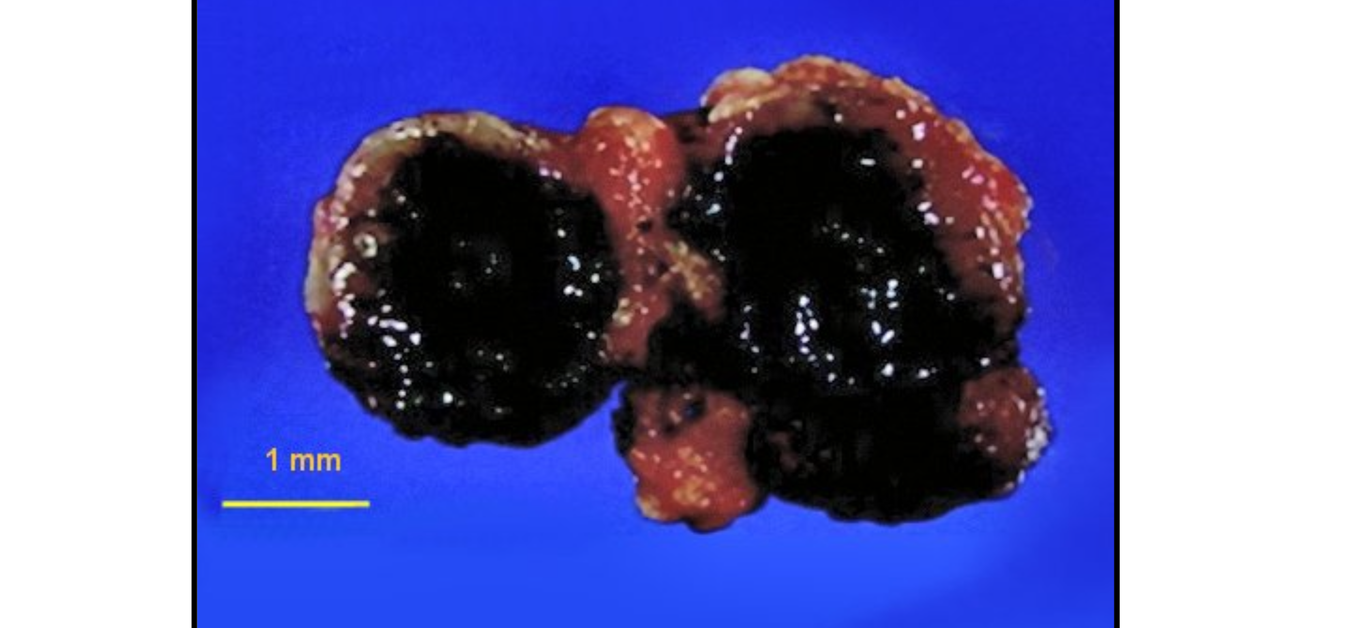 <p>Bệnh lý gì</p>