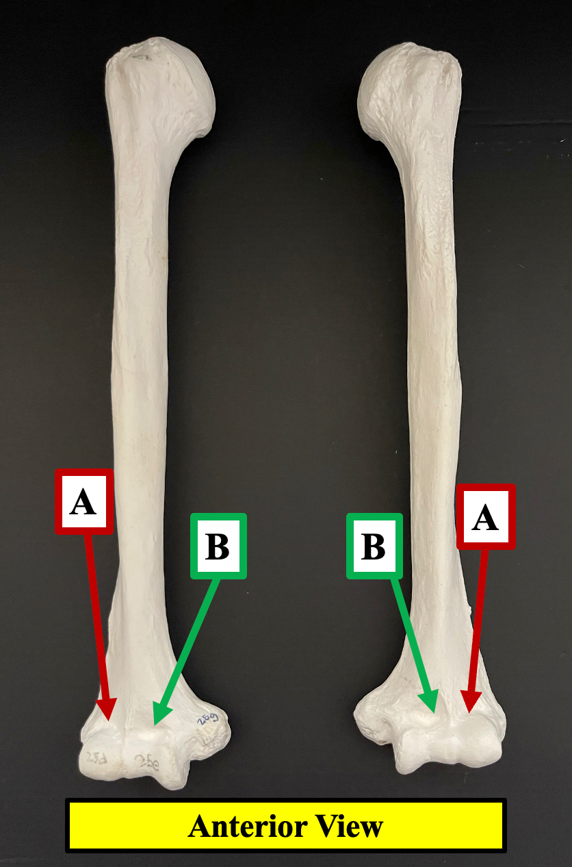 <p>Identify the name of the depression of the humerus that label <strong>A </strong>is pointing to.</p>
