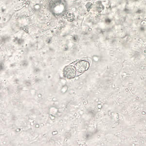 <p>Wet Mount</p>