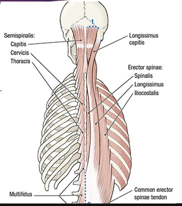 <ul><li><p>Long muscles of the back, paraspinal muscles</p></li></ul><p>Action:</p><ul><li><p>Bilateral contraction: extension of the vertebral column and control of posture</p></li><li><p>Unilateral contraction: lateral flexion of vertebral column</p></li></ul><p>Innervation:</p><ul><li><p>segmentally innervated by <span style="color: red;">dorsal rami</span></p></li></ul><p></p>