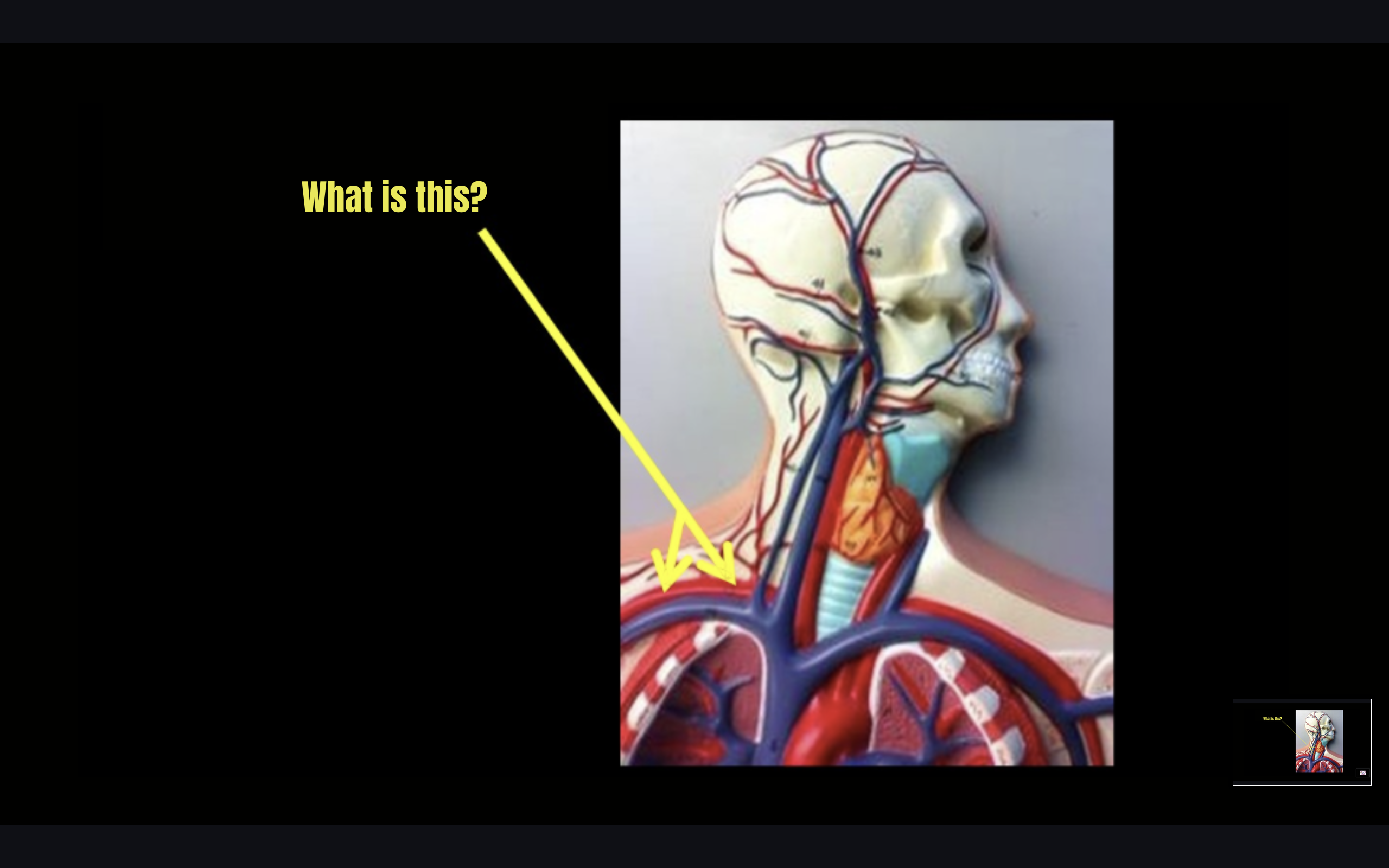 term image