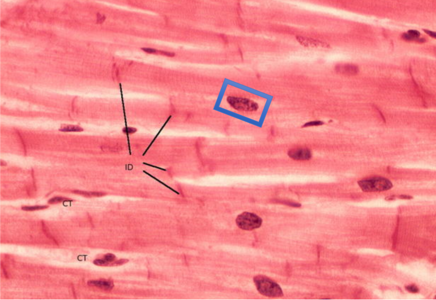 <p>Hallmarks: Intercalated Discs, endomysium (CT)</p>