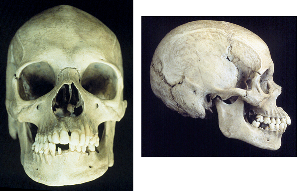 <p>what is the ancestry of this skull?</p>