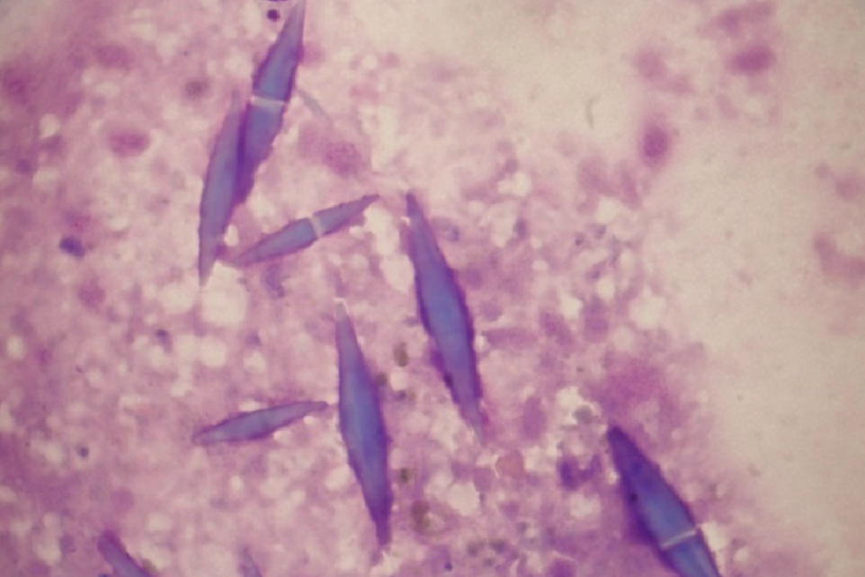 <p>Name</p>