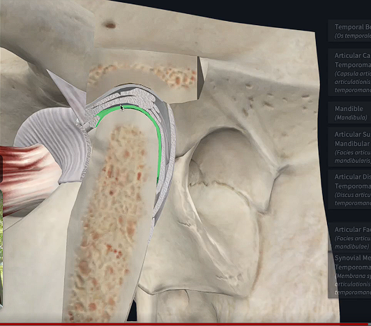 <p>In the TMJ, what cavity is this?</p>