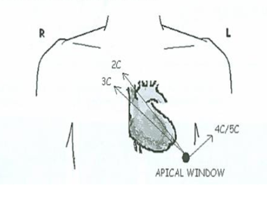 <p>4, 2 and 3. </p>