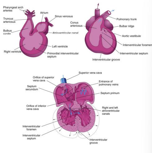 <ol><li><p>Protrusions of endocardium from the floor of the primordial ventricle extend toward the inferior endocardial cushion and form the muscular part of interventricular (IV) septum. </p></li><li><p>Ventricular myocytes also contribute to the IV septum.</p></li><li><p>IV foramen forms between the free edge of the IV septum and the fused endocardial cushions to permit blood flow between ventricles. </p></li><li><p>Week 7: IV foramen closes with formation of membranous part of IV septum </p></li><li><p>Cavitation of the ventricular walls forms a spongelike mass of muscular bundles, the trabeculae carneae, papillary muscles and chordae tendineae.</p></li></ol><p></p>