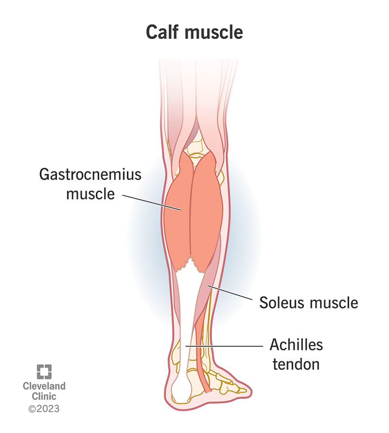<p>Medial head—posterior surface of distal femur just superior to medial condyle;</p><p>lateral head—upper posterolateral surface of lateral femoral condyle</p>