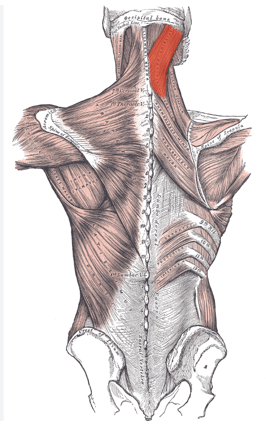 <p>Identify the highlighted muscle </p>