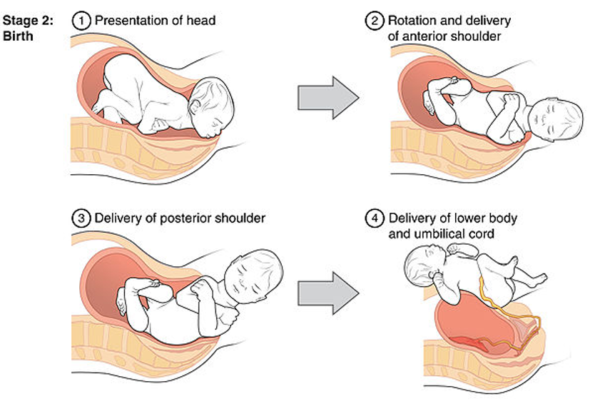 <p><span style="font-family: "Tw Cen MT Condensed";">The second stage of labour – delivery of foetus</span></p>
