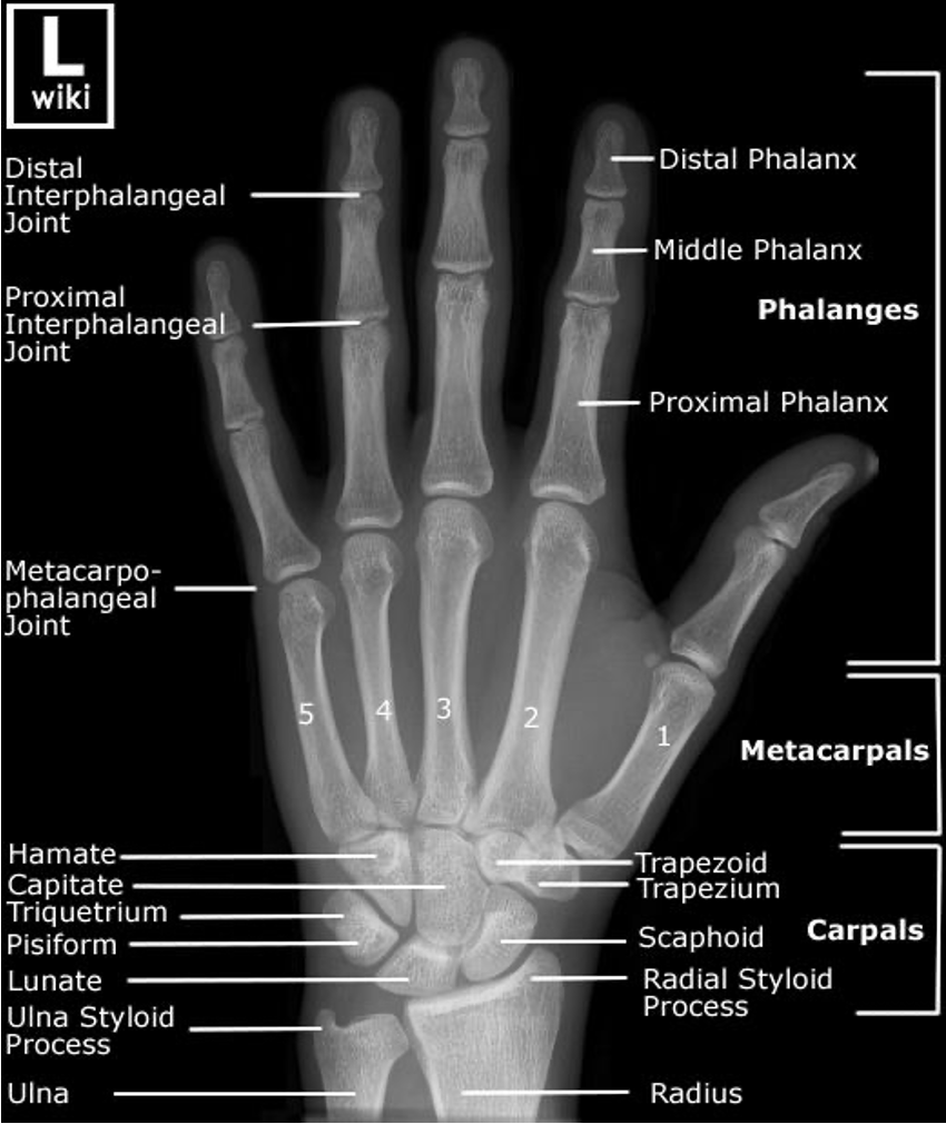 <ul><li><p>Scaphoid injury most important </p></li></ul><p></p>