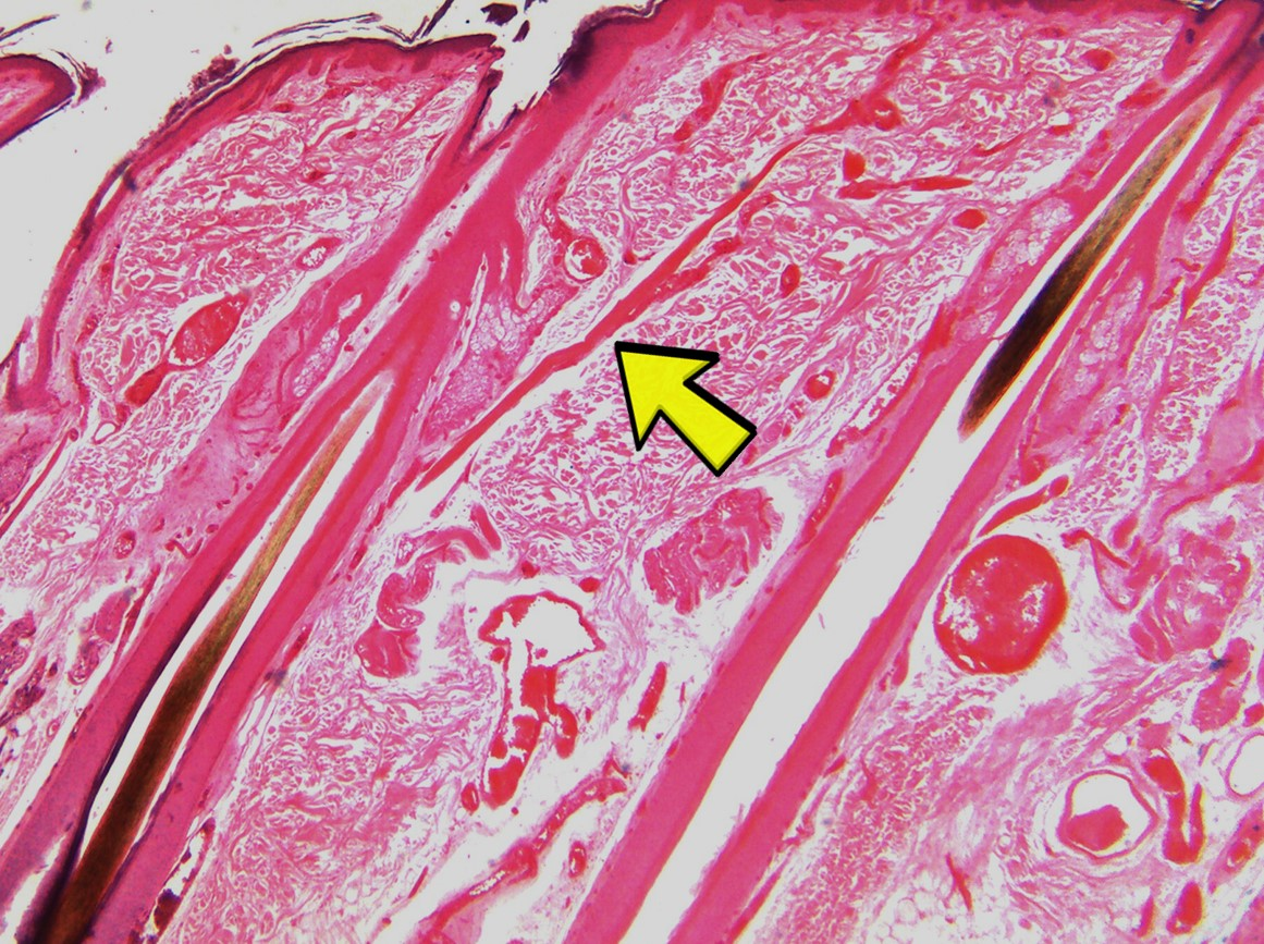<p><span>Identify the structure in the micrograph at the yellow arrow.</span></p>