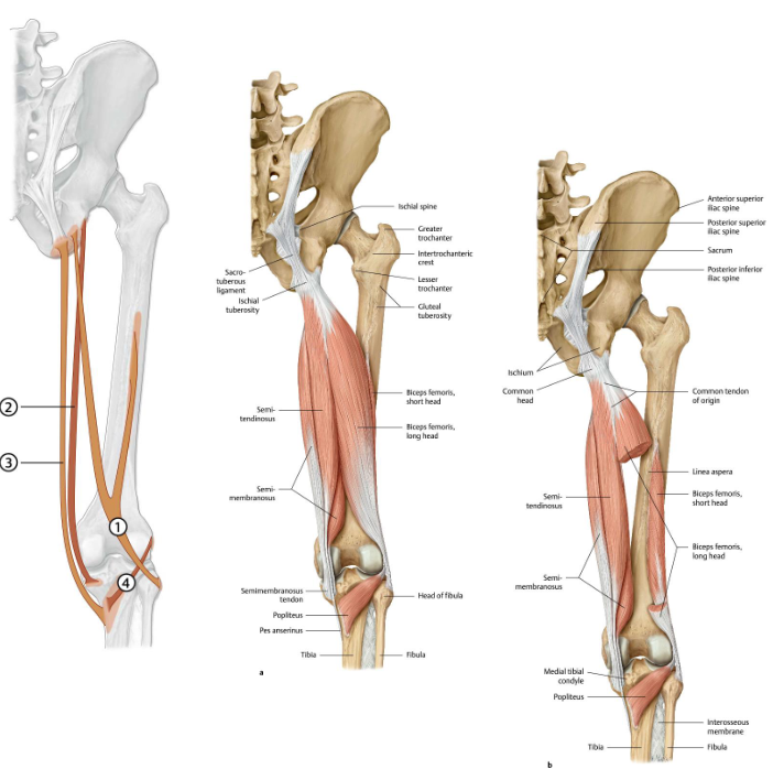 <p><strong>origo</strong>: tuber ischiadicum</p><p><strong>insertie</strong>: mediale tibia condyl (profundaal van de pes anserinus, dus pes anserinus profundus)</p><p><strong>functie</strong>: </p><ul><li><p>art. coxae: <strong>retroflexie</strong>, stabilisatie van het bekken in sagittale vlak</p></li><li><p>art. genu: <strong>flexie</strong>, endorotatie</p></li></ul><p><strong>innervatie</strong>: N. ischiadicus (n. tibialis; L5-S2)</p><p></p><p></p>