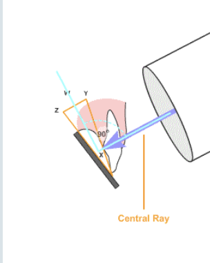 <p>the bisecting angle technique is only used for?</p>