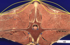 <p>What are you looking for on soft tissue palpation of horses with axial pain?</p>