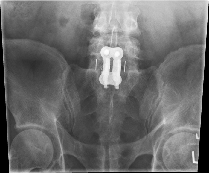 <p>critique this AP axial SI joint</p>