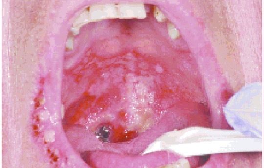 <p>CHẨN ĐOÁN ?</p>