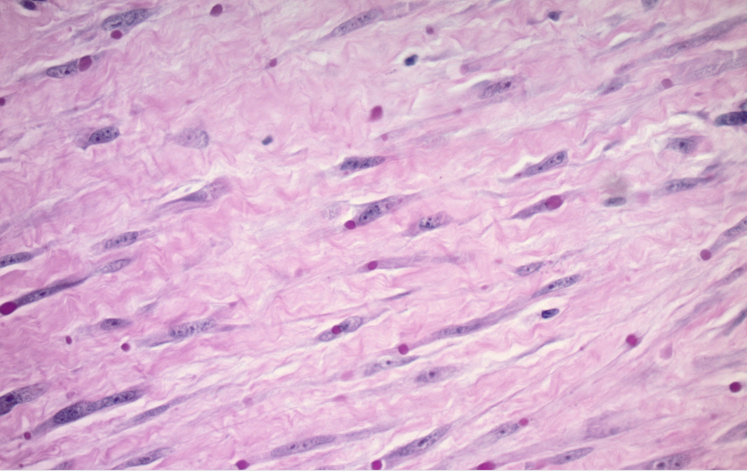 <p>Nodules face dorsale index enfant de 3 ans </p><p>Diagnstic</p><p>Age </p><p>localisation</p><p>Histologie </p><p>IHC </p>