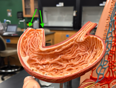 <p>What is the arrow pointing at?</p>