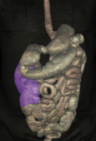 <p>what is highlighted of the large intestine</p>