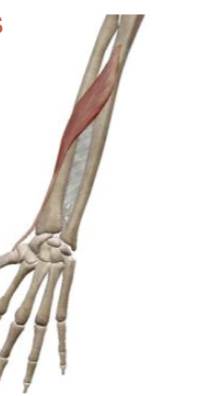 <p>what muscle and action is this </p>