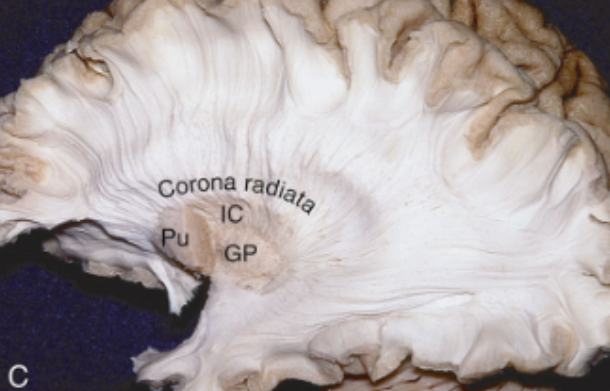 <p>corona radiata</p>