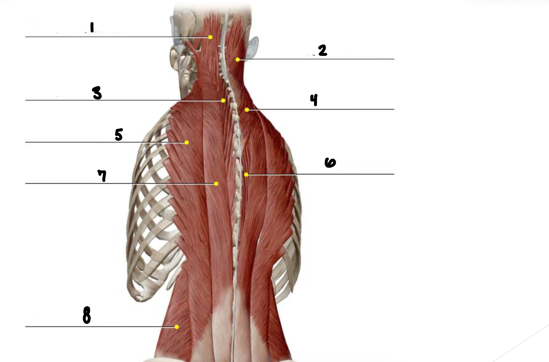 <p>Label muscles 1-8 of the vertebral column </p>