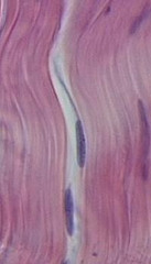 <p>Function: attaches muscles to bones or to muscles; attaches bones to bones; withstands great tensile stress when pulling force is applied in one direction</p>